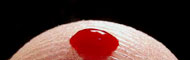 Coagulation sanguine, thrombose